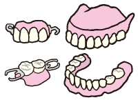 本来あるべき歯の代わり