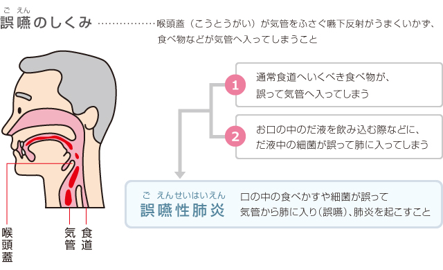 誤嚥のしくみ