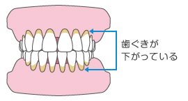 口腔ケアってなーに？