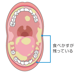 口腔ケアってなーに？