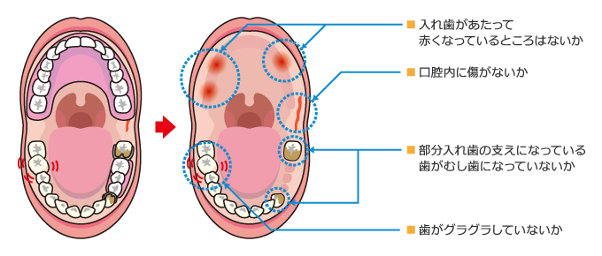 クリームタイプの使い方