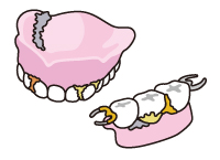 入れ歯の汚れるポイント