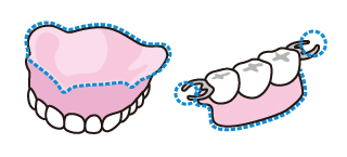 部分入れ歯の場合