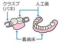 入れ歯の構造