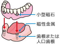 磁石式