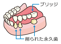 ブリッジ