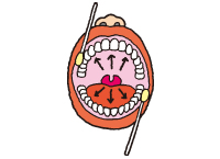 お口の粘膜ってなーに？