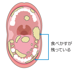 お口の粘膜ってなーに?
