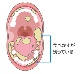 お口の粘膜ってなーに？