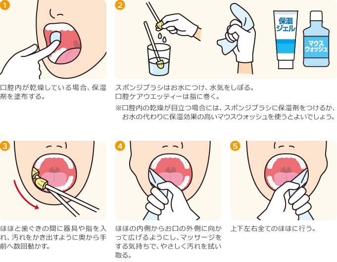 頬の内側 はじめよう やってみよう 口腔ケア