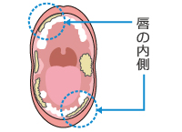 唇の内側にはこんな汚れがたまります