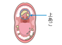 唇の内側にはこんな汚れがたまります