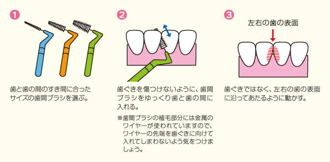 歯間ブラシとフロス はじめよう やってみよう 口腔ケア