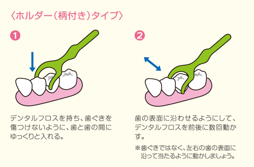 歯間ブラシ